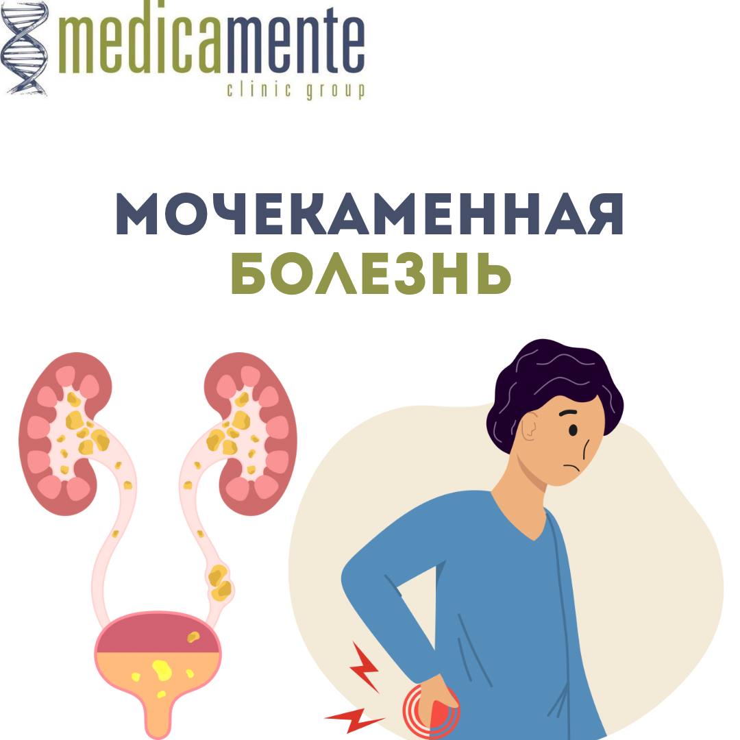Мочекаменная болезнь